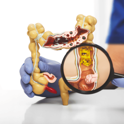 cirujano-oncologo-colon-y-recto-costo